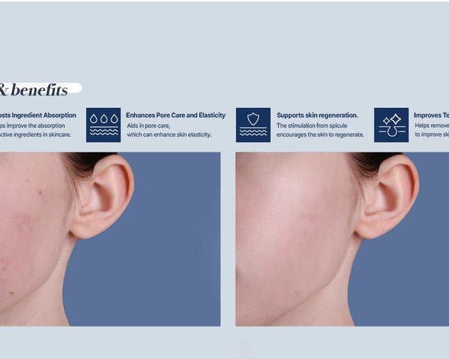 Exoblanc Spicule Cream - Premium Korean aesthetic-level skincare